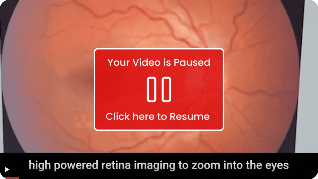 Your Video is Paused (1)